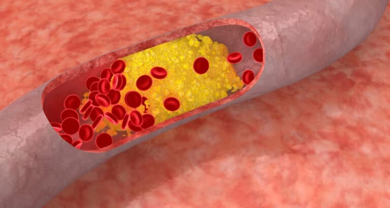 Wat is een gezonde cholesterolwaarde?