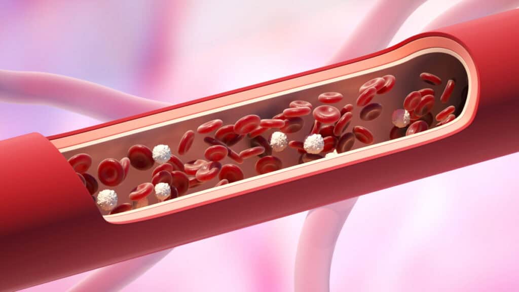 Hoog cholesterol is één van de belangrijkste risicofactoren voor hart- en vaatziekten.