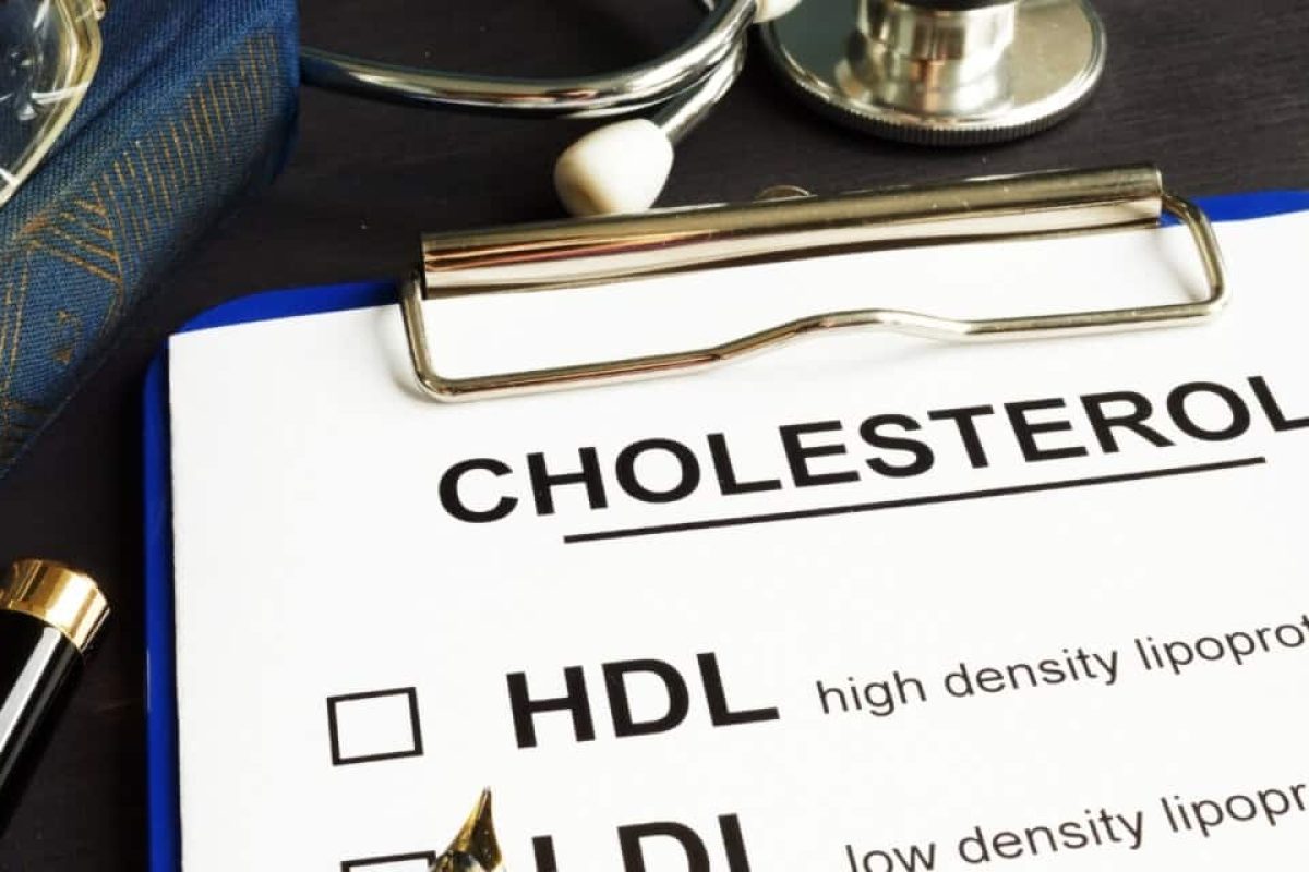 Hoe vaak moet ik mijn cholesterol laten controleren?