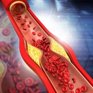 Groepslogo van Erfelijk cholesterol en lipidenstoornissen